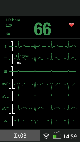 Monitor de pacientes portátil M850 SPO2 ECG