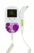 Monitor Fetal Doppler Spengler (sonda 2, 5 y 8 Mhz opcional)