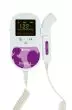 Monitor Fetal Doppler Spengler (sonda 2, 5 y 8 Mhz opcional)