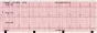 Electrocardiógrafo ECG Veterinario Edan VE300 (3 pistas)
