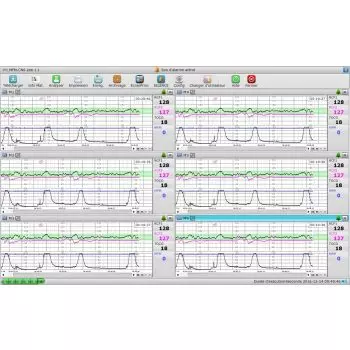 Software para PC MFM-CNS Lite para el cardiotocógrafo Edan F3