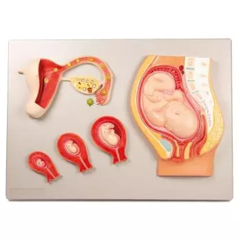 Modelo de desarrollo fetal de Erler Zimmer