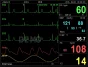 Monitor de paciente multiparamétrico GIMA PC-3000 (TA, SpO2, Temp., Resp, ECG)