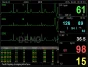 Monitor de paciente multiparamétrico GIMA PC-3000 (TA, SpO2, Temp., Resp, ECG)