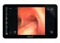 Monitor de endoscopia portátil Ambu aView 2 Advance