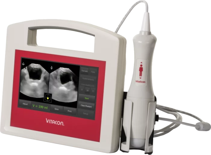 Bladder scanner / escáner de vejiga Vitascan