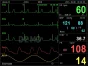 Monitor de paciente multiparamétrico GIMA PC-3000 (TA, SpO2, Temp., Resp, ECG)