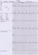 Electrocardiógrafo ECG Veterinario Edan VE300 (3 pistas)
